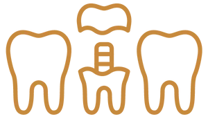 Prótese dentária em Curitiba